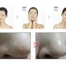 피부봄날 이미지