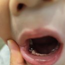 봄봄어린이치과의원 이미지