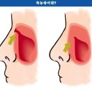 삼성메디 이미지