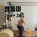 광명오픈아트홀 | 쌍둥이 26주 임신기록 증상, 배크기, 육아휴직, 분서대 초진, 트립트랩, 라이프 오브 파이 박정민