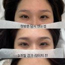 초잉브로우