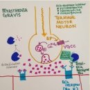 myasthenia gravis(1) 이미지